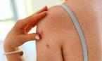 Những con mồi sập bẫy spa ngon, bổ, rẻ