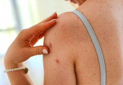 Những con mồi sập bẫy spa ngon, bổ, rẻ